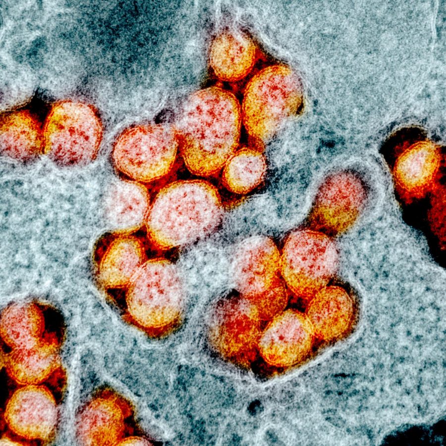 A transmission electron micrograph of COVID-19 cells from a patient.